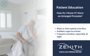 how do i know if i have an enlarged prostate