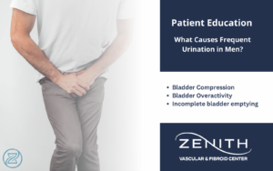 what causes frequent urination in men